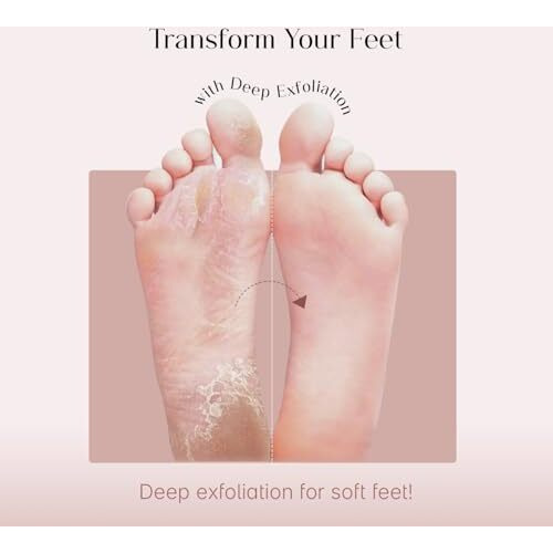 Seoulskin Glycolic Acid Foot Peeling Mask, 150000 Ppm (1 Pair) Korean Peeling & Exfoliating | Deep Exfoliation With Glycolic Acid, Hydrates & Softens, Removes Dead Skin, Cruelty-Free, Vegan, Paraben-Free Foot Peel Off Mask For All Skin Types