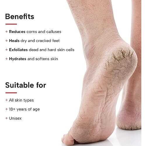 Dermatouch Xero Cream | Specially For Dry & Cracked Feet | Soothes & Moisturizes |For Corns & Calluses| For Both Men & Women | 50G