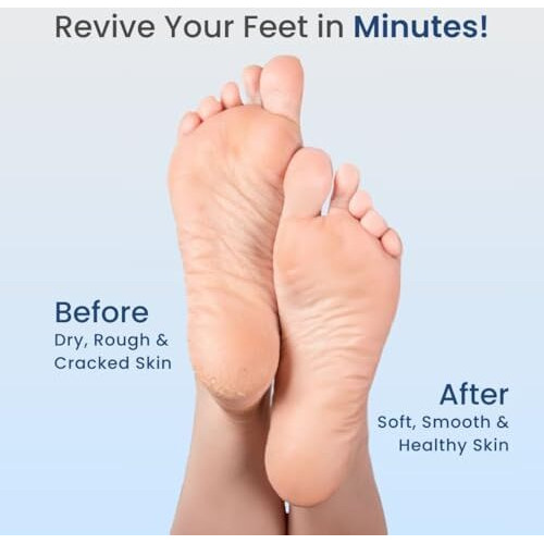 Medtech Revive Rechargeable Callus Remover | Electric Foot Scrubber For Dead Skin Removal | 3 Crystal Quartz Heads For Dead Skin Removal | Pedicure Machine For Home | Pedicure Kit For Women