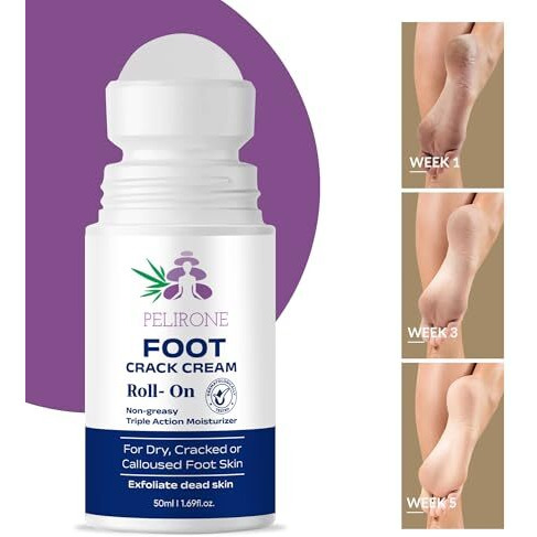 Pelirone 20% Urea Foot Cream Roll On 50Ml | For Dry & Cracked Heels | With 2% Lactic Acid, Olive Oil & Vitamin E | Helps Repair And Moisturise Cracked Heels