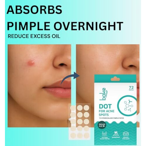 Bake 2% Salicylic Acid Hydrocolloid Pimple Patches (72 Dots) | Absorbs Oil, Prevents Acne | Waterproof Patches | For Acne, Acne Marks, Acne Prone Skin - 72 Patches