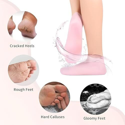 Unidsc Moisturizing Silicone Gel Socks For Dry Feet Repair Deep Hydration For Cracked Skin Ultimate Foot Care Treatment For Soft & Revives Feet Overnight (Pack 1)