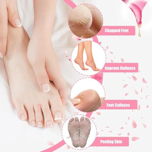 Kaththai Moisturizing Silicone Gel Socks For Dry Cracked Feet - Repairing And Softening Winter Lotion Socks (Multicolor)