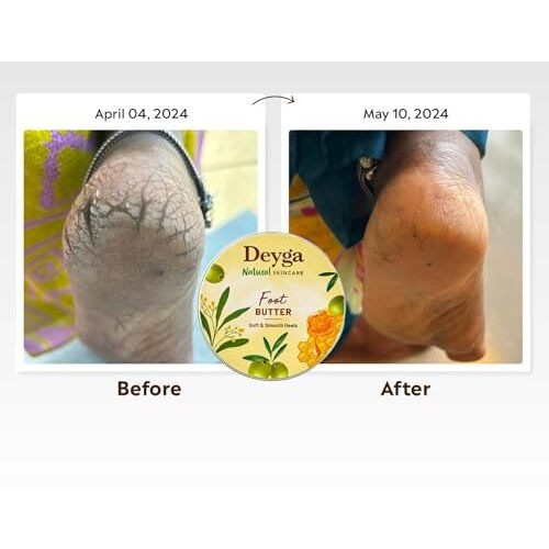 Deyga Foot Cream Trial Pack | For Dry And Cracked Feet | Moisturizes Rough Heels | Suitable For All Skin Types| Foot Butter For Men & Women| Prevents Wrinkles (10 Gram - Trial Pack)