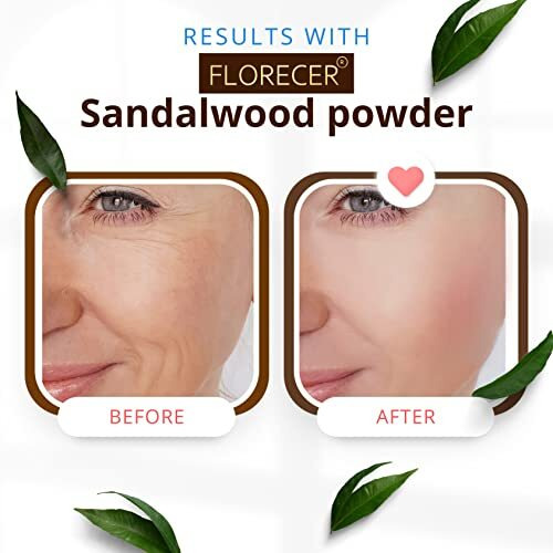 Florecer Sandalwood Powder For Face Pack| Pure And Natural | Organic | Glowing Skin | Face Mask | Chandan Powder - (Acne And Tan Removal Face Pack) 100 Grams