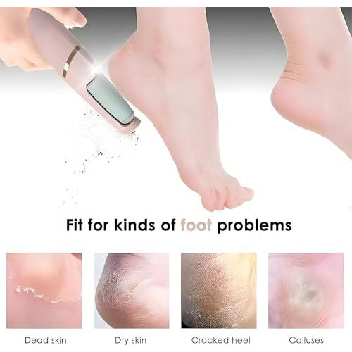 Feelon Foot Callus Remover For Dead Skin, Rechargeable Pedicure Device For Women's Feet With 2 Roller Heads, Pedicure Kit For Women For Foot