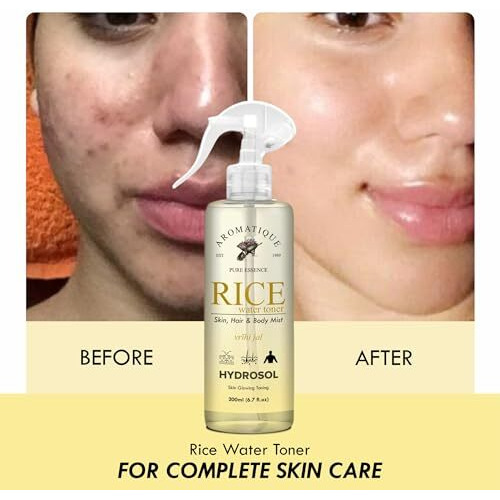 Aromatique Rice Water Toner For Face/Mist Spray/Hydrosol - Hydrating,Nourishing Skin - Brightens, Revitalizes, Softens - For All Types - Daily Use 200Ml