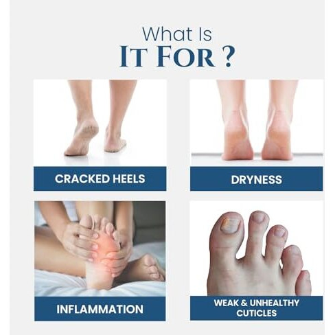 Uniqaya Foot Care Cream Repairs Cracked Heel | Crack Heel Repair Cream For Women & Men, Moisturizes Dry Feet, Combats Feet Odour & Infections