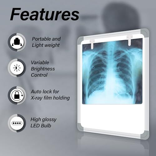 Otica Led X-Ray View Box Fully Automatic For Hospital With Variable Brightness Control (Extra Bright Led)