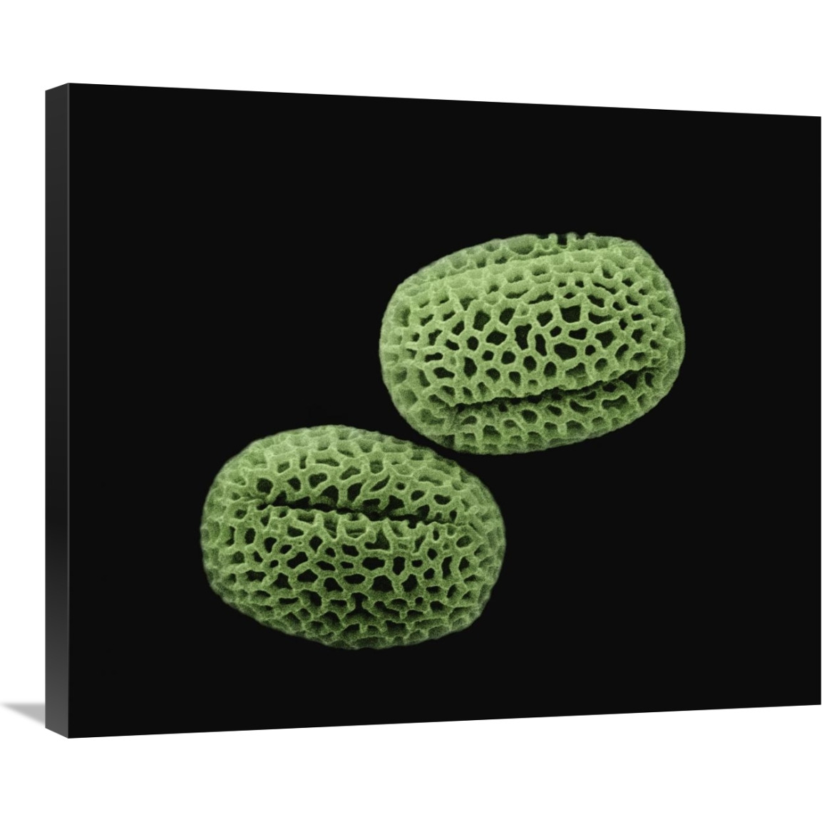Olive (Olea europaea) pollen at 1400x magnification-Canvas Art-30&quotx24.9"