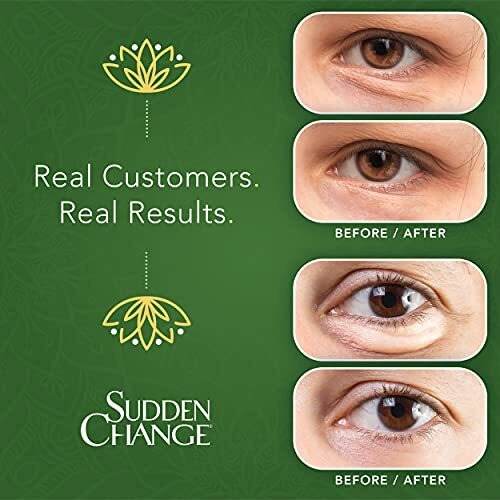 Sudden Change Instant Under-Eye Firming Serum - (Classic Formula) Under-Eye Bags Treatment For Puffiness, Lines, & Wrinkles - Wear With Or Without Makeup - 3 Minute Results (023 Oz, Pack Of 3)