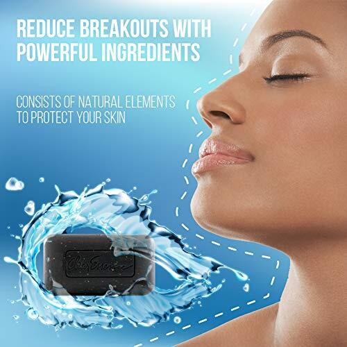 Exfoliating Face Soap For Women By Clear Essence- Medicated Cleansing Bar For Oily, Acne Prone Skin And Blemishes, Platinum Line, 4.7 Oz. (1 Pack)