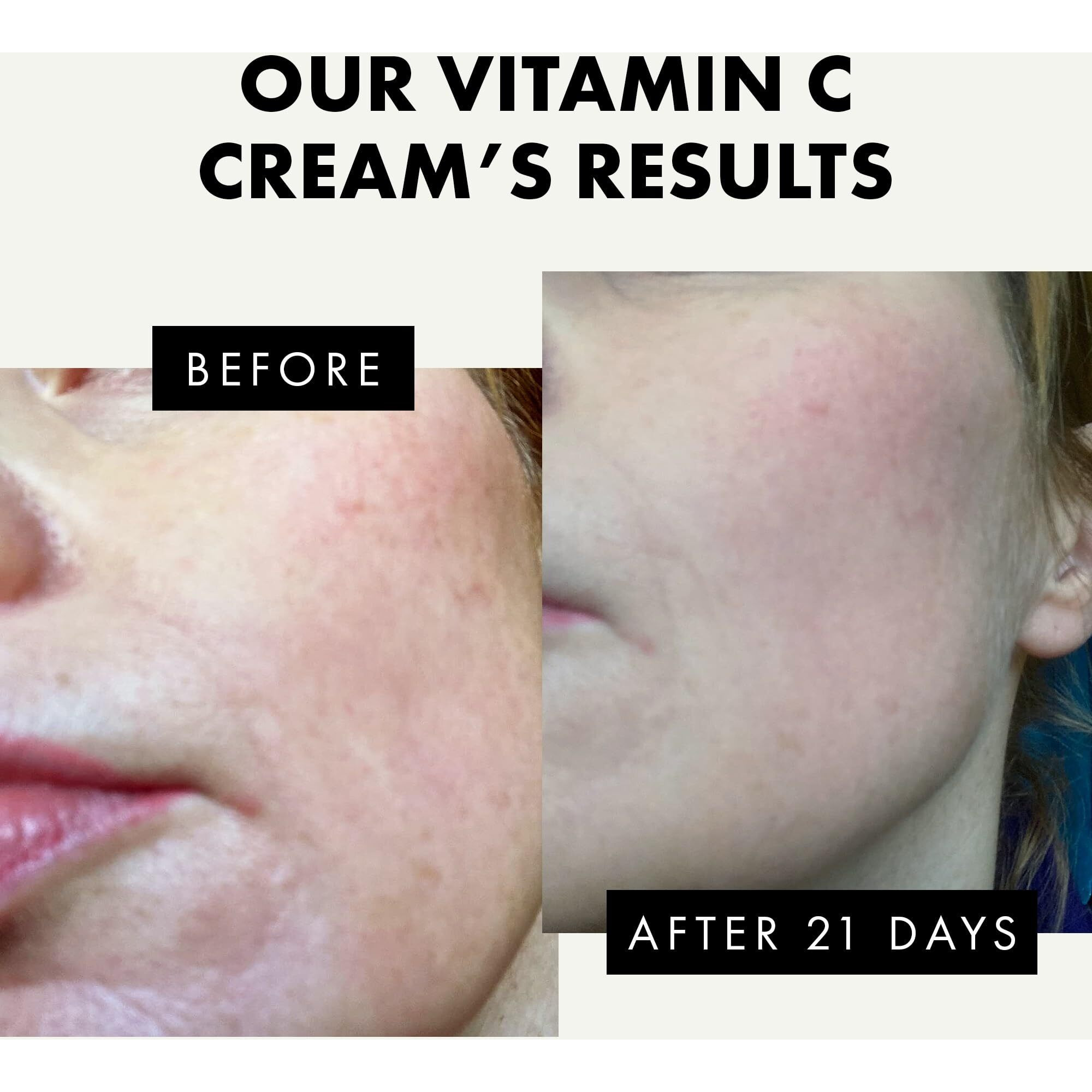 Vitamin C Face Moisturizer - Skin Whitening Cream Hyaluronic Acid Face Cream Brightening Cream Lotion - Vitamin C Facial Moisturizer - Dark Spot Remover For Face Morning Night Cream & Radiant Skin
