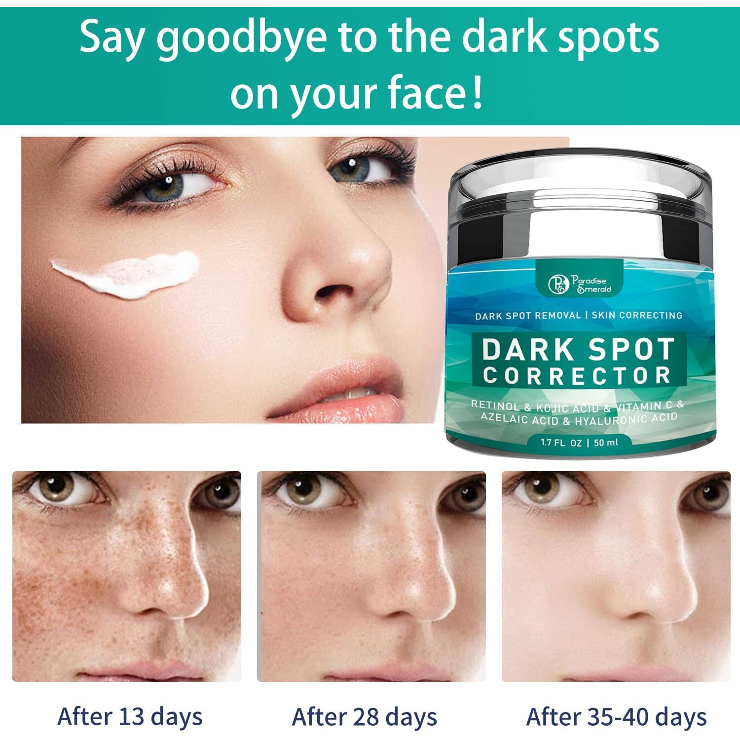 Paradise Emerald Dark Spot Remover For Face, Hyperpigmentation Treatment, Melasma, Freckle, Sun Spots Removal For All Skin Types Dark Spot Corrector For Men And Women