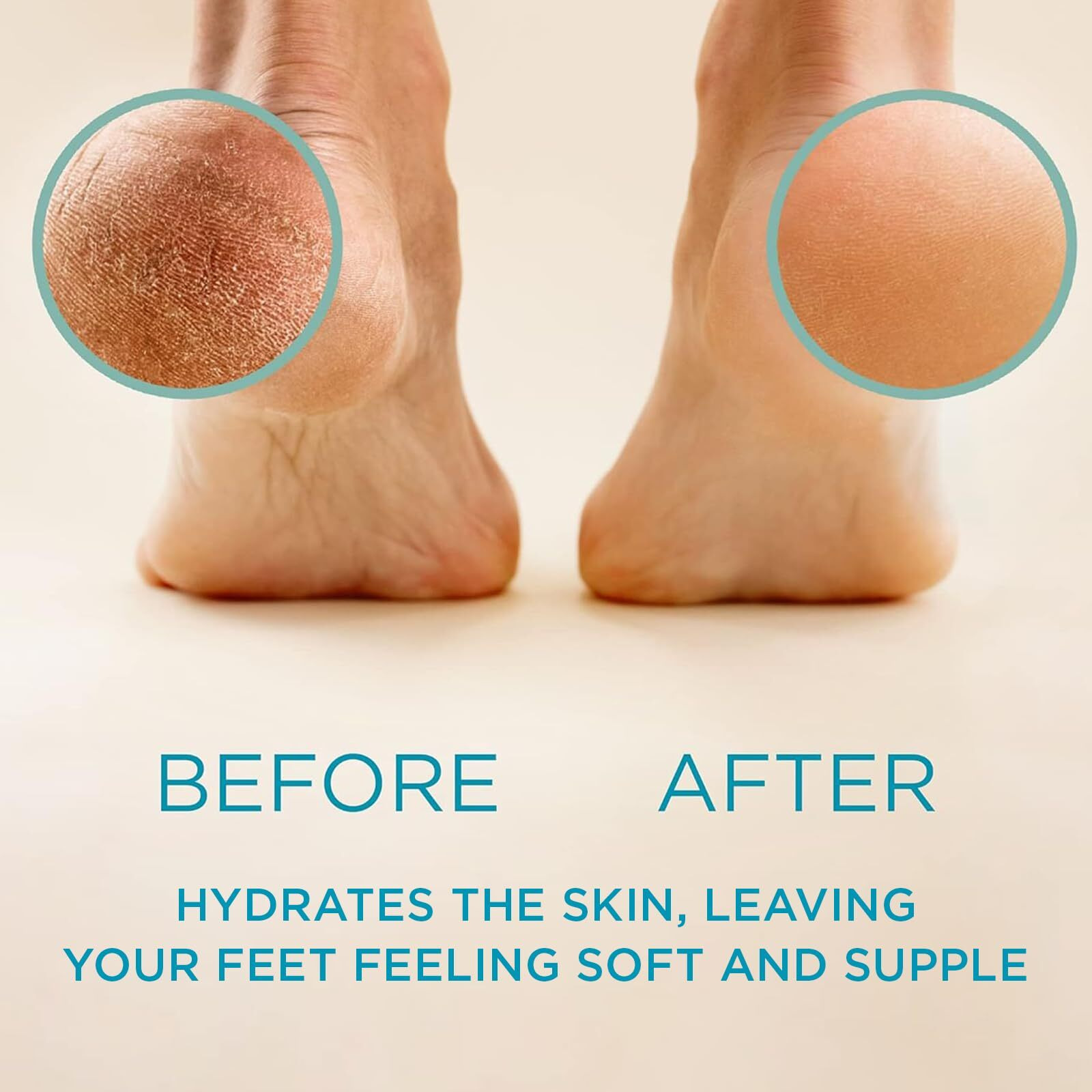 Lee Beauty Professional Callus Remover For Feet - Extra Strength Gel & Rasp Foot File Kit - Original Formula For Dead Skin Remover For Cracked Heels & Dry Skin-Pedicure Supplies For Smooth Foot - 8 Oz