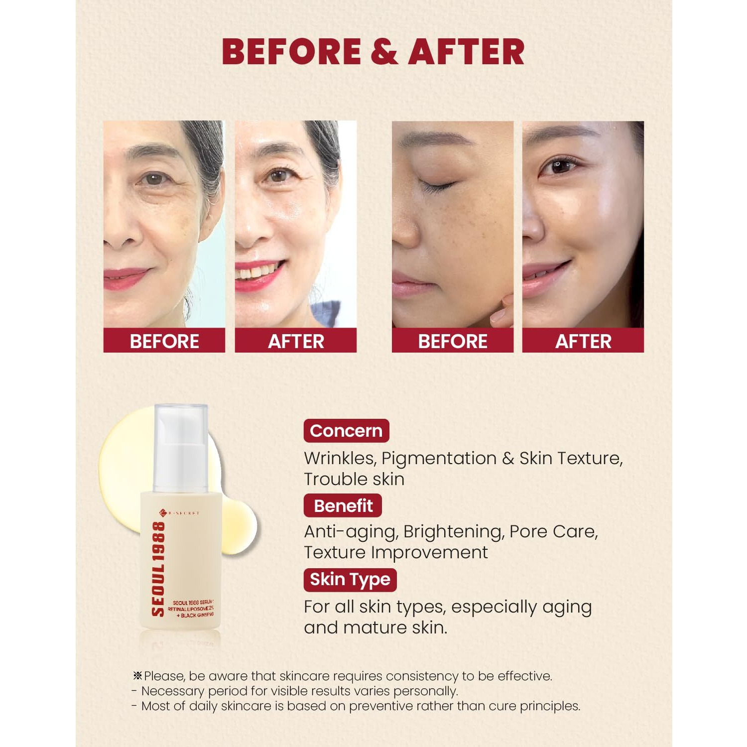 Ksecret Seoul 1988 Serum  Retinal Liposome 2% + Black Ginseng, 30Ml/1.01Fl.Oz | 58% Black Ginseng Extract | Retinal Serum, Bakuchiol, Vitaminc&3Peptides For Wrinkle Care | Korean Skincare | Seoul1988