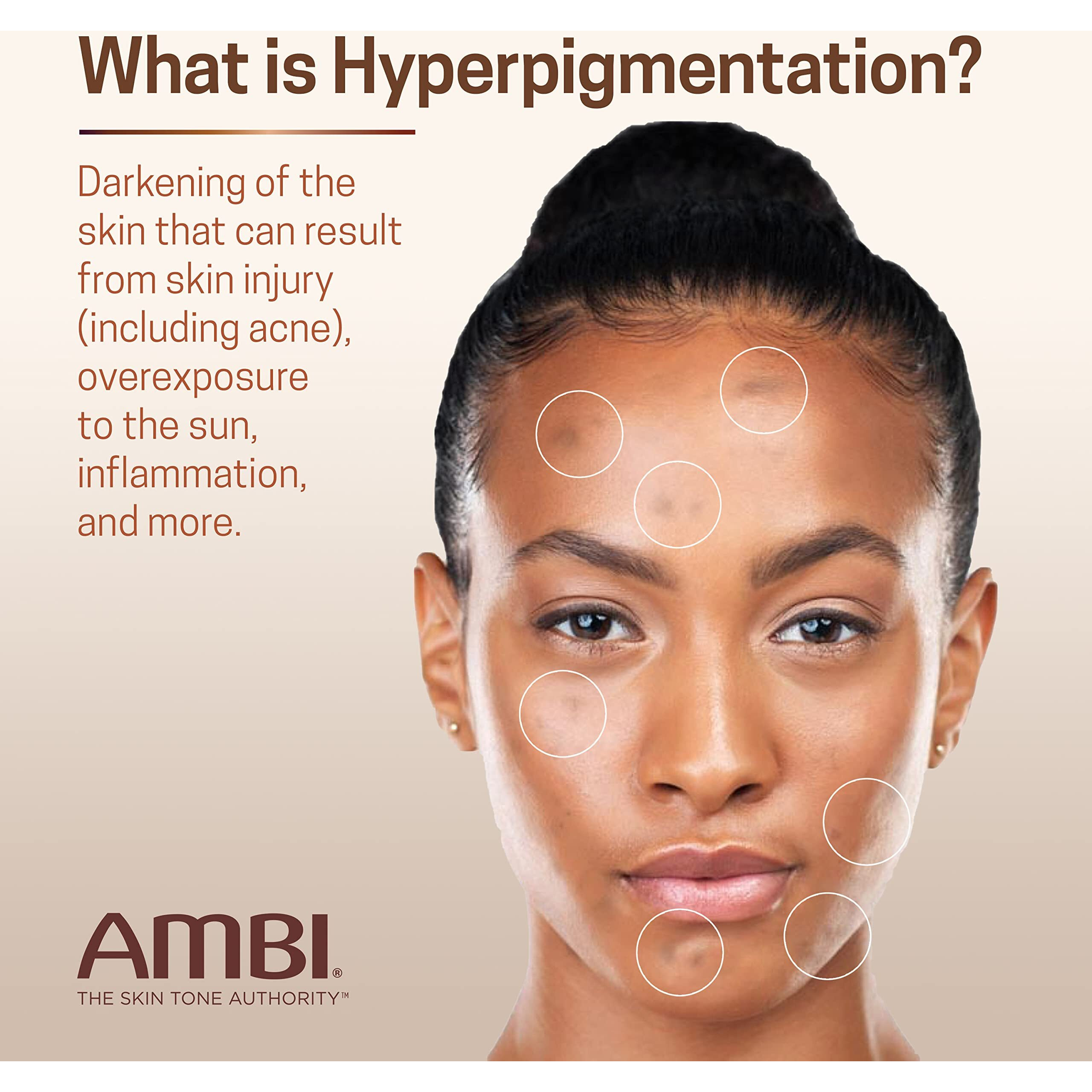 Ambi Even & Clear Fade Cream, Hydroquinone-Free, Hyperpigmentation Treatment, Dark Spot Corrector, Results In As Little As 4 Weeks, Niacinamide, Aloe Vera, Vitamin C, 1 Fl Oz