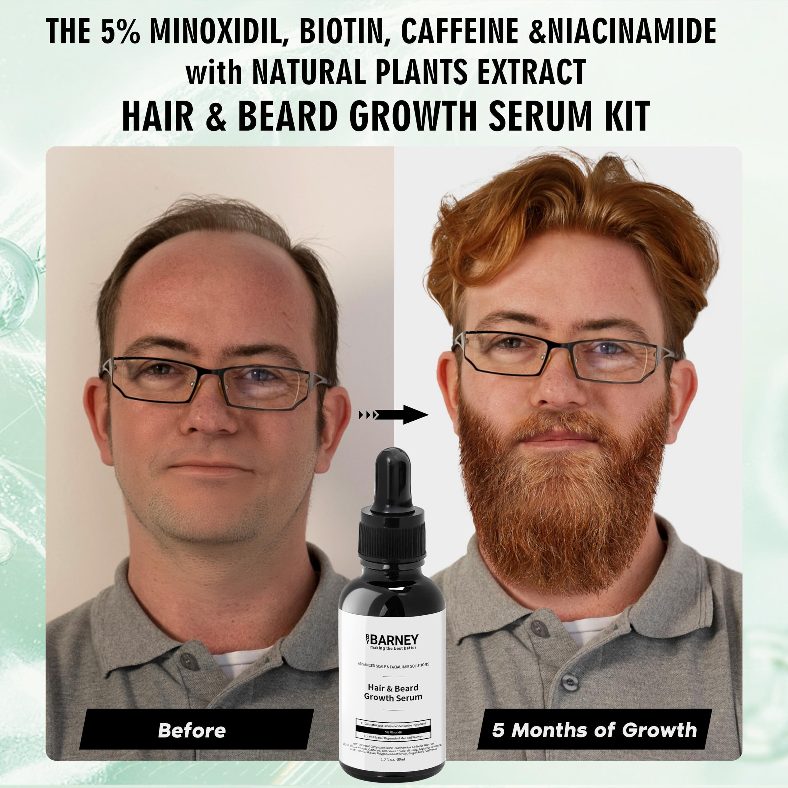 5% Minoxidil Hair And Beard Growth Serum - Natural Extracts, Biotin & Caffeine - Promotes Stronger, Thicker, Fuller Hair And Beard Growth - For Men And Women