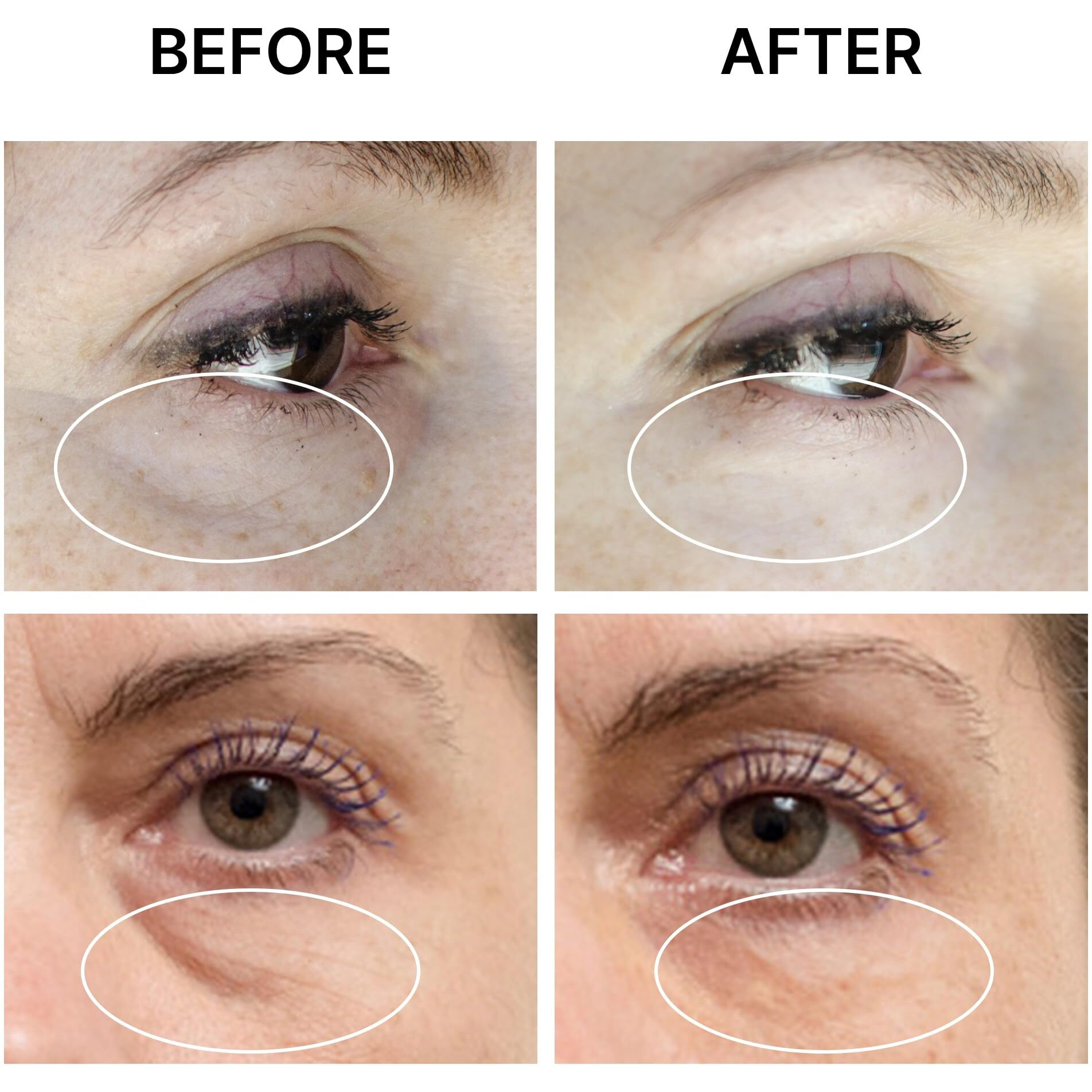 Seamantika Puffiness Away - Instant Results - Naturally Eye Cream For Rapid Reduction Of Eye Bags, Puffiness, Wrinkles, And Dark Circle. Made With Dead Sea Minerals 0.8 Fl.Oz