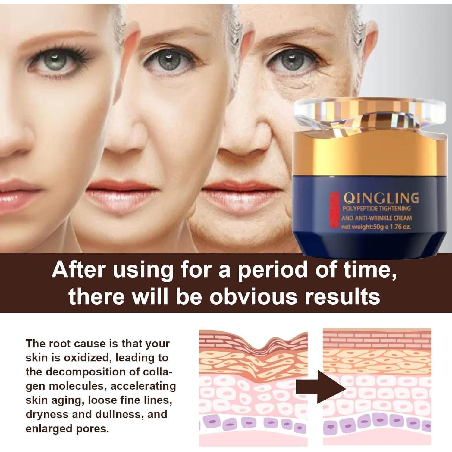 Qingling Crema Para Arrugas, Qingling Face Cream, Qingling Wrinkle Removal Cream, Polypeptide Tightening And Anti-Wrinkle Cream, Firming Anti-Aging Eye Cream For Women Men (2)