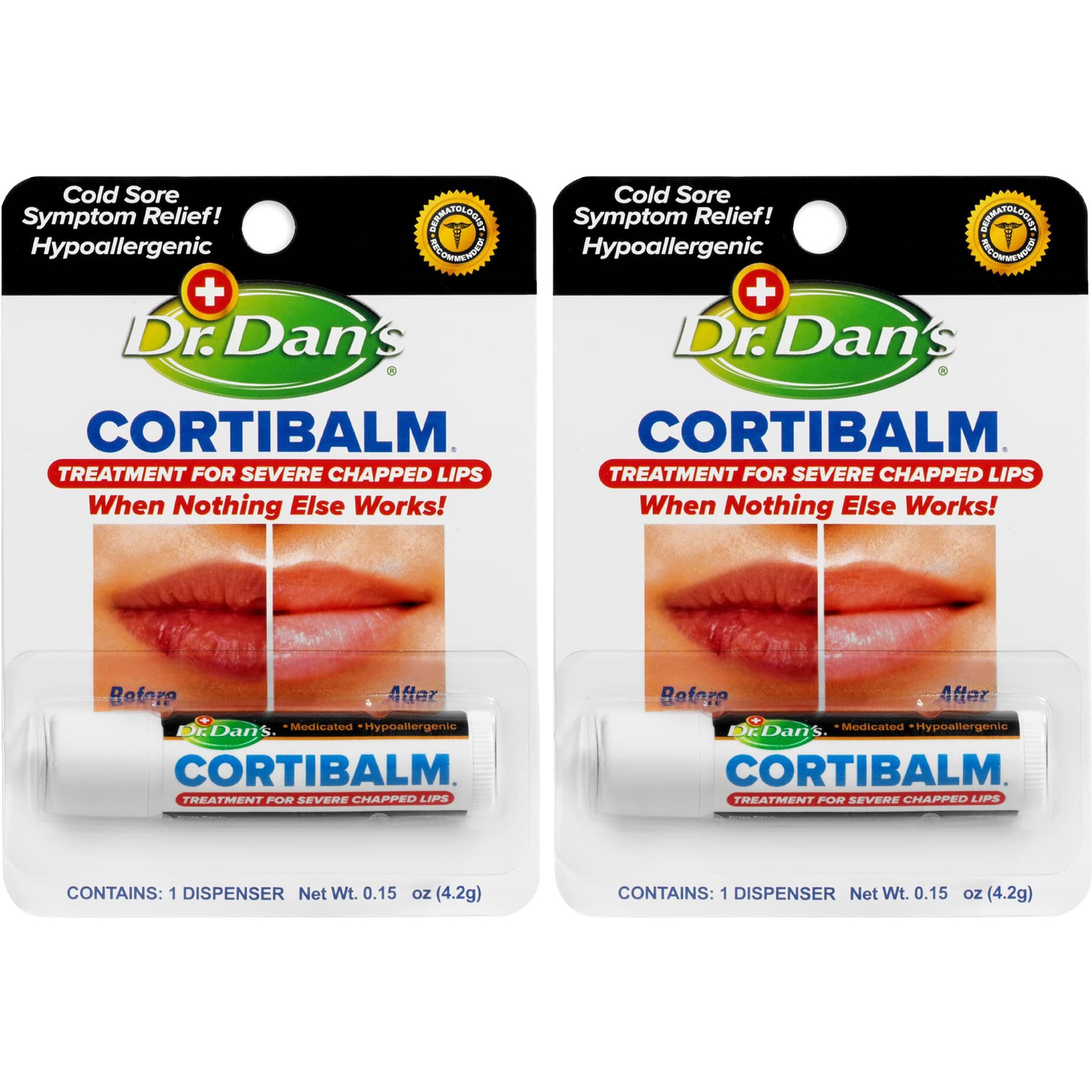 Dr. Dan's Cortibalm- 2 Pack- For Severe Chapped Lips And Cold Sore Relief