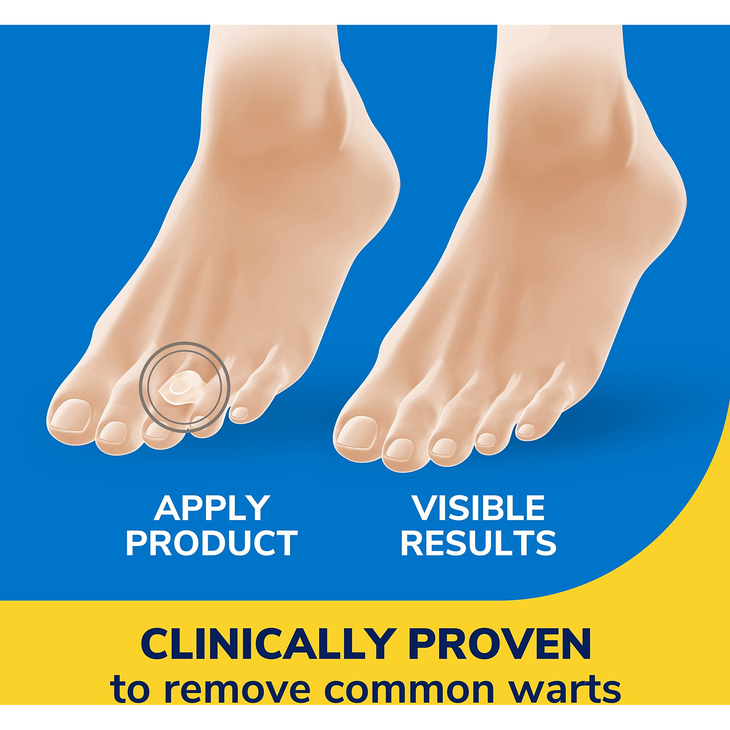 Dr. Scholl's Clear Away Wart Remover Hydrogel Bandage // 12 Discs/9 Cushions, Clinically Proven, Immediate & All-Day Cushioning Pain Relief, Multi-Day Coverage, 12 Treatments