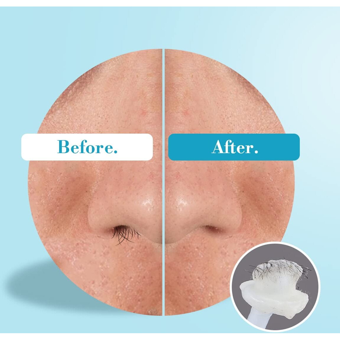 Oakeer Nose Hair Remover Kit With 30 Wax Sticks For Men And Women - 100G Nose Wax For At-Home Hair Removal