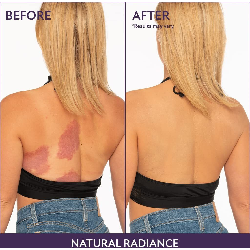 Westmore Beauty Body Coverage Perfector - Waterproof Leg & Body Makeup - Tattoo Cover Up Makeup - 7 Oz (Natural Radiance)