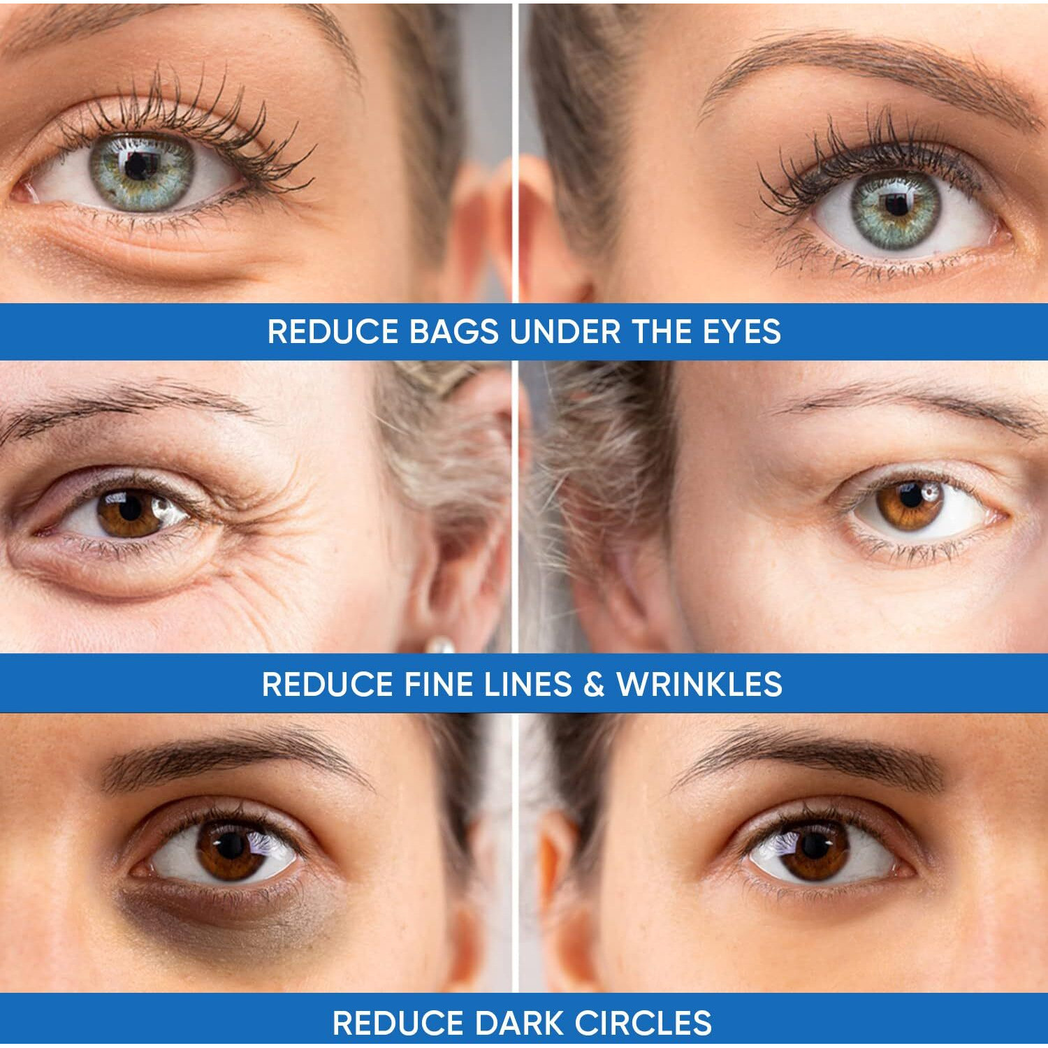 Under Eye Puffiness & Dark Circles Rapid Treatment- Instantly Reduces The Appearance Of Puffy Eye Bags, Crows Feet, & Sagging Skin.