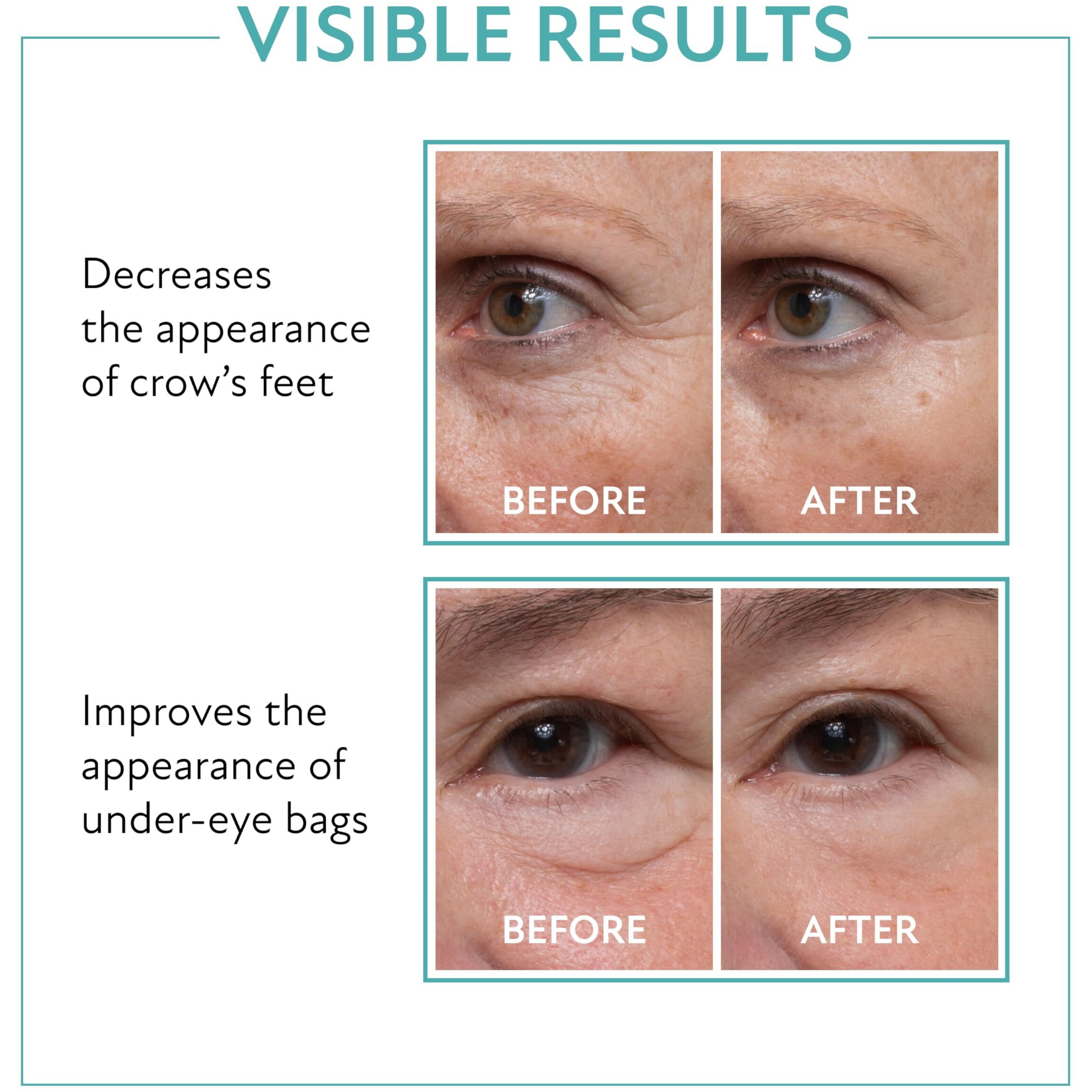 Westmore Beauty 60 Second Eye Effects Tinted Firming Gel - Instant Tightening Serum, Under-Eye Cream For Puffiness And Bags - Light To Medium, 0.33 Fl Oz (10 Ml)