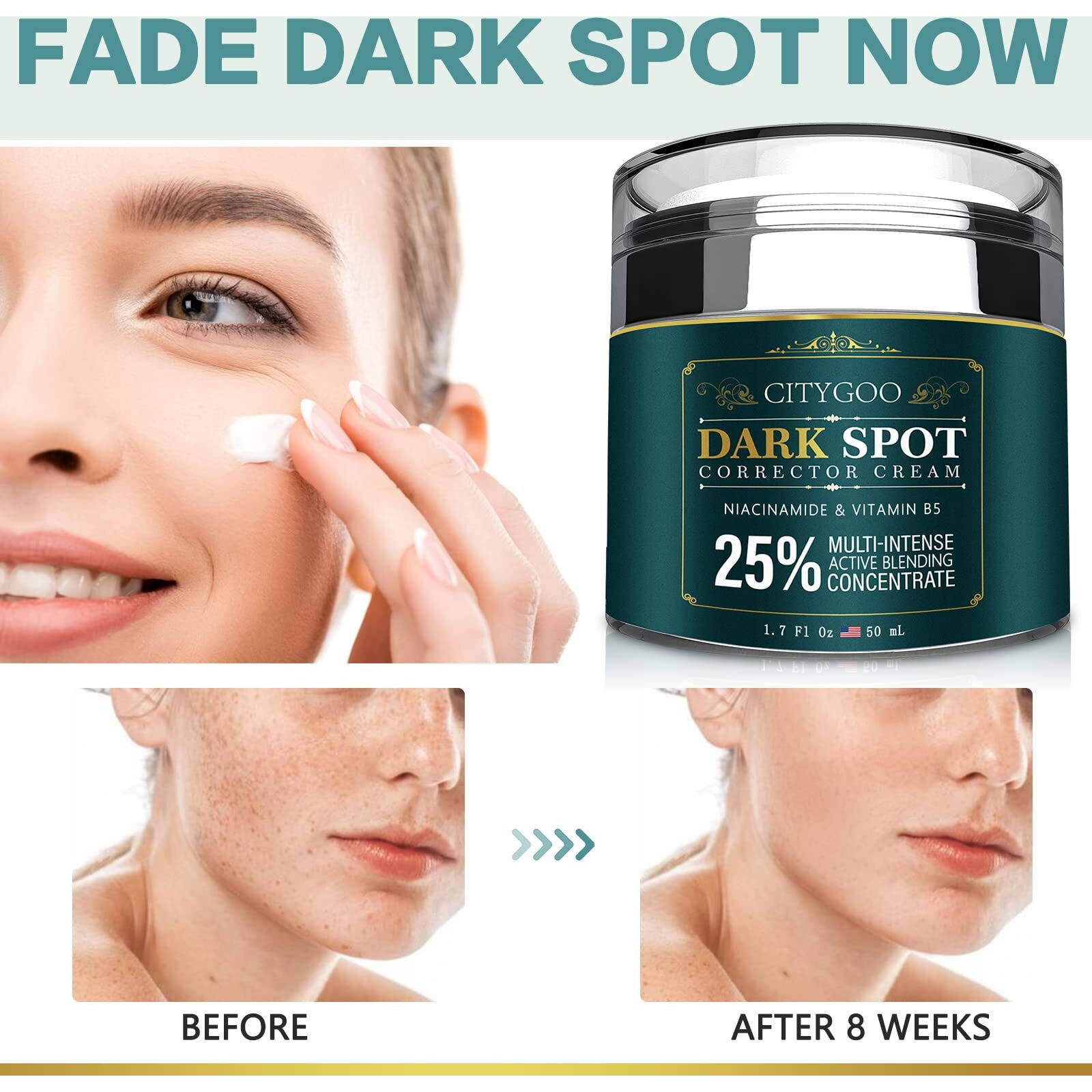 Citygoo Dark Spot Remover For Face And Body, Corrector Cream, Natural Ingredient,Enriching Skin Care For All Skin Tones - Melasma, Freckle, Sun Spot Remover & Blemish Reducer-1.7 Fl Oz