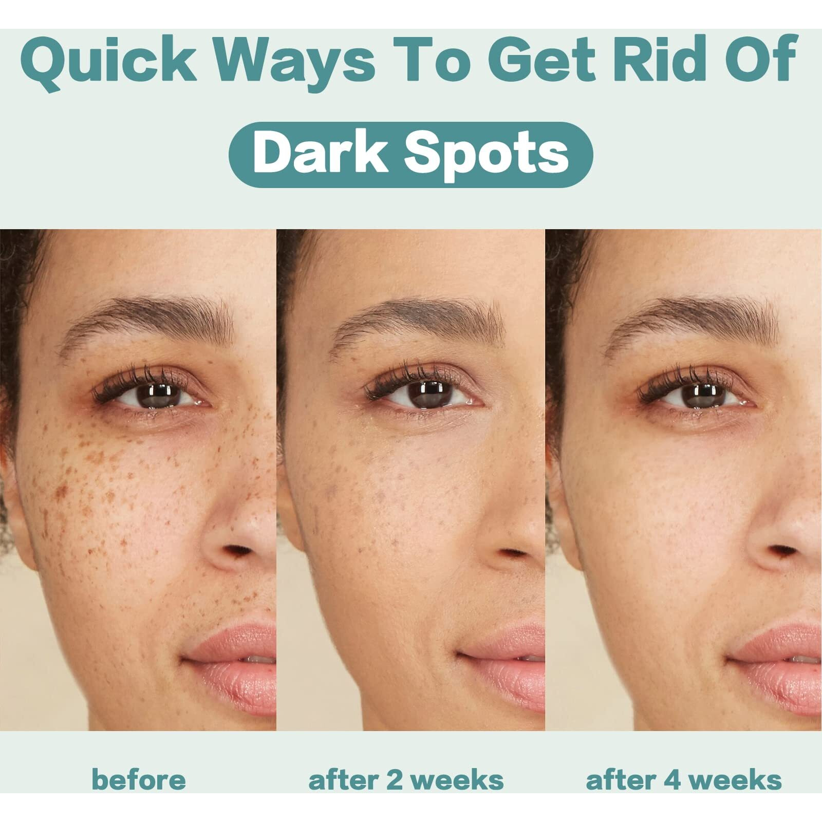 Citygoo Dark Spot Remover For Face And Body, Corrector Cream, Natural Ingredient,Enriching Skin Care For All Skin Tones - Melasma, Freckle, Sun Spot Remover & Blemish Reducer-1.7 Fl Oz