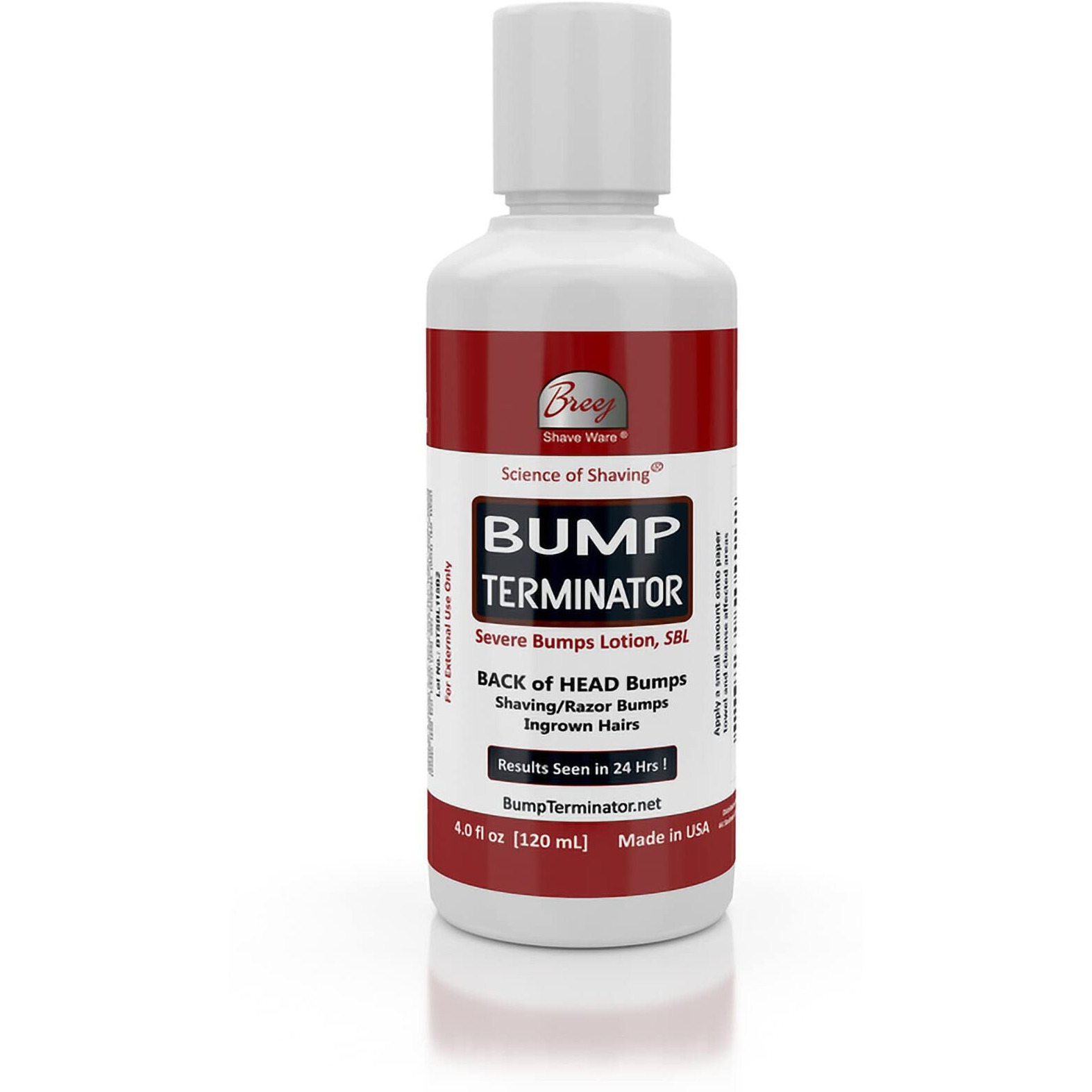 Bump Terminator Severe Bumps Lotion (4Oz)