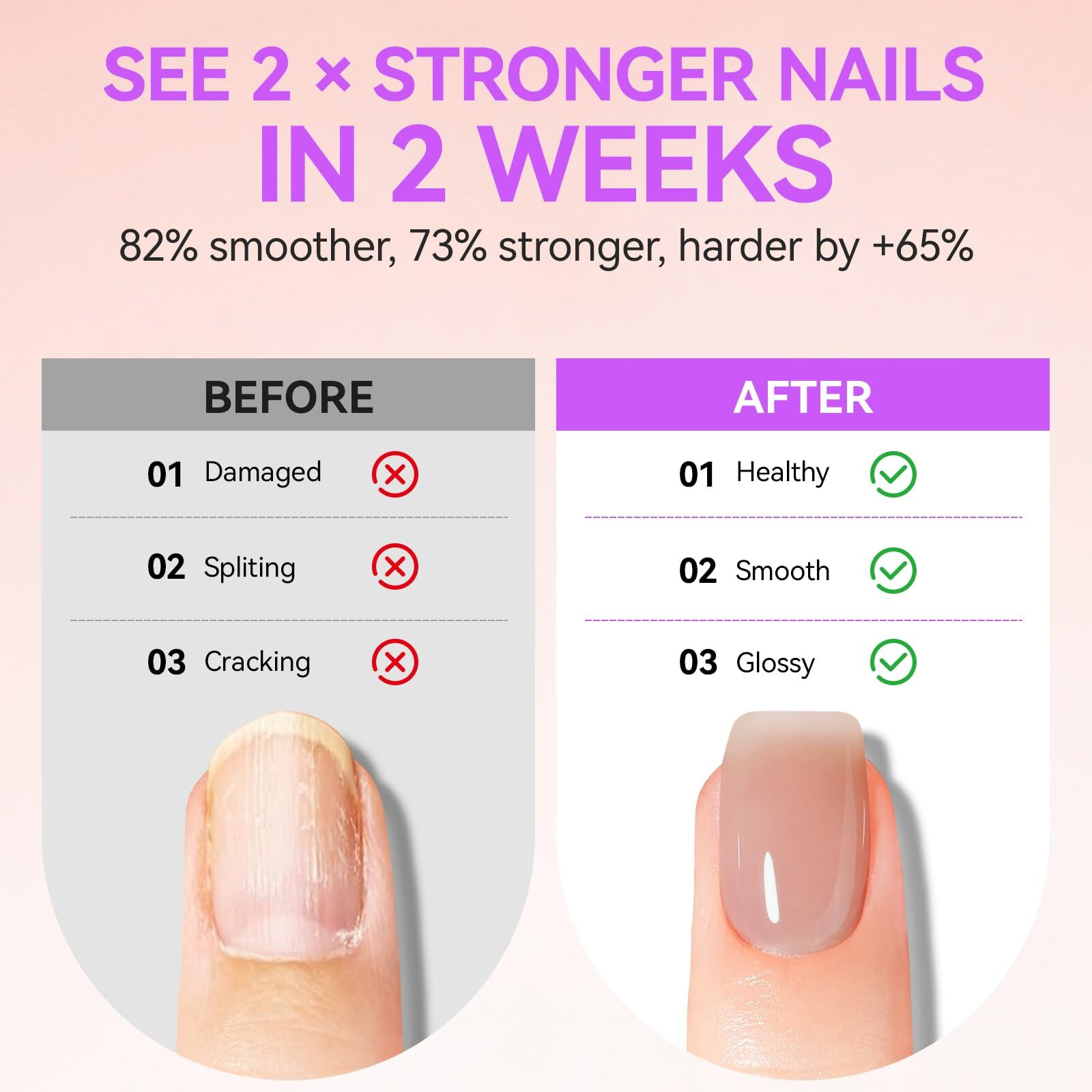 Gelike Ec Professional Nail Care Kit Nude Nail Growth Treatment & Watermelon Cuticle Oil (15Ml) - Hydrating Protein Care For Dry Nails - Lightweight Non-Sticky - Perfect For Summer Manicures