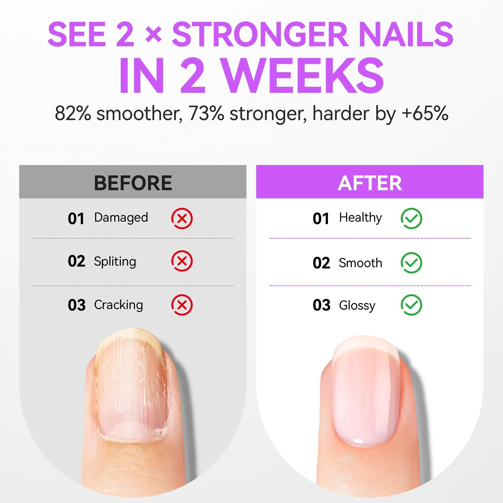 Nail Growth Treatment And Cuticle Oil Orange & Clear (15Ml) - Protein Nail Hardener For Weak Nails - Vitamin E Enriched - Fast Growth & Repair - Salon & Home Use