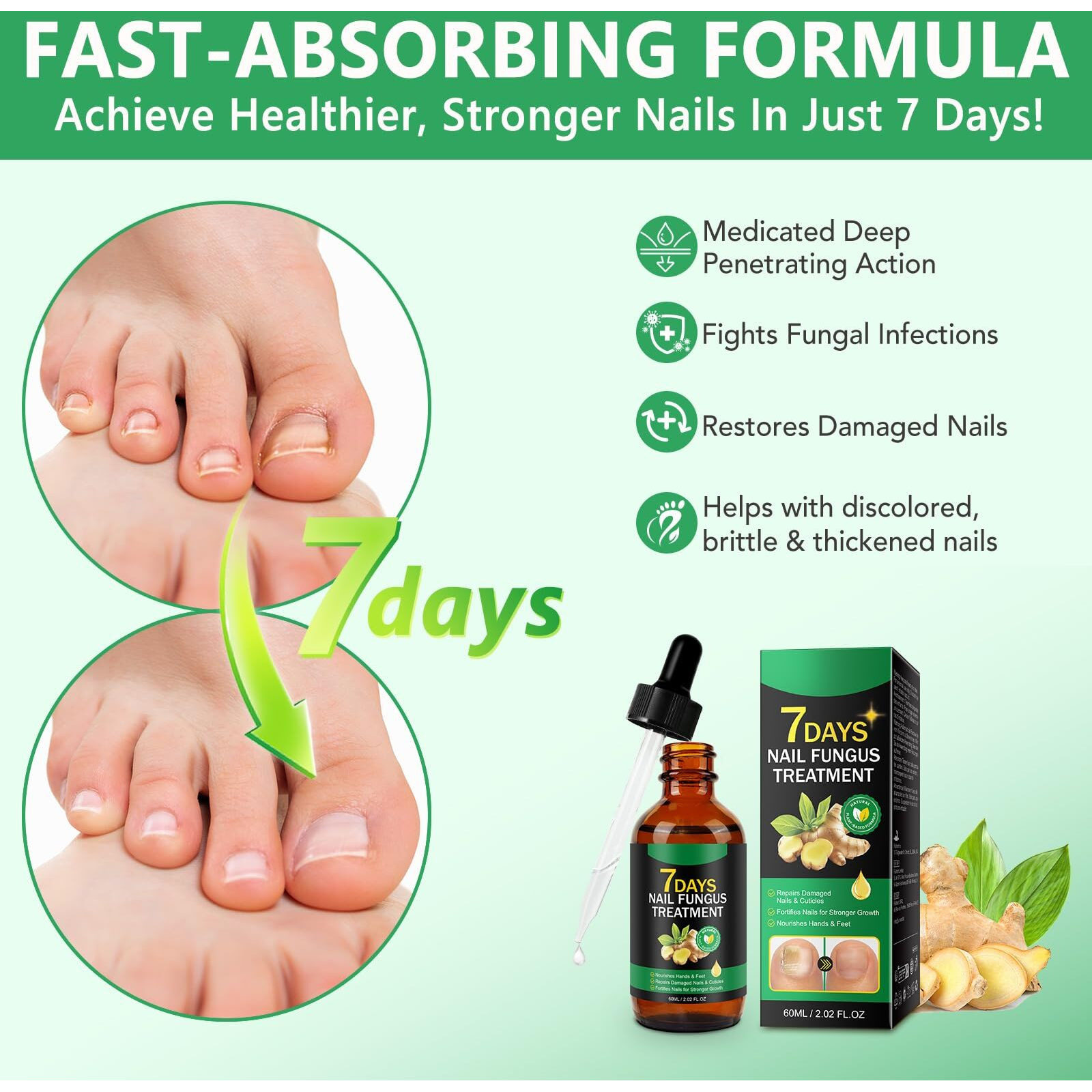 Ginger Nail Growth Strengthener Serum - Ginger-Infused Nail Repair Oil For Care, Natural Nail And Strengthener Solution