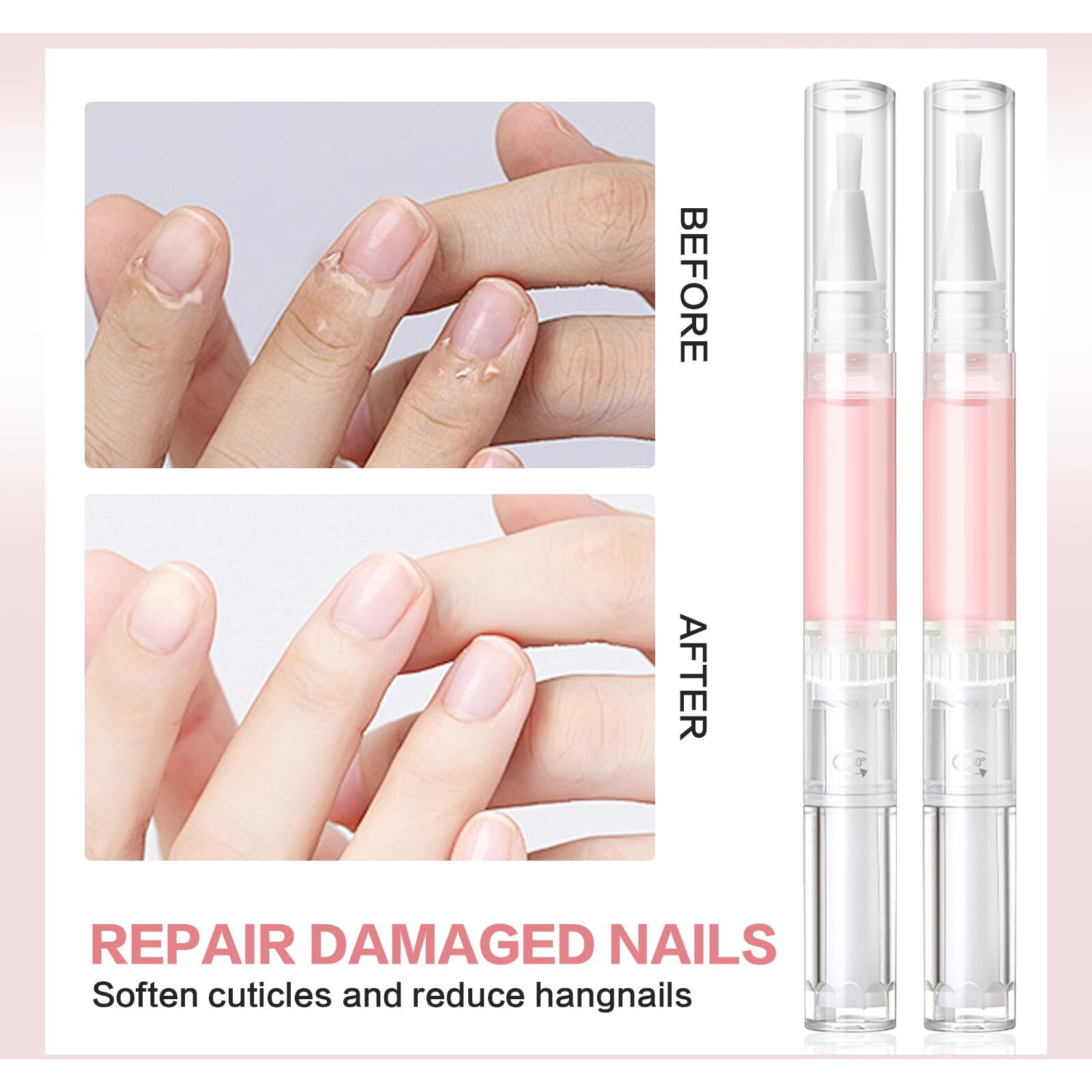 Radiant Nail Growth Oil, Nail Strengthener, Cuticle Oil For Nails, Moisturize Strengthen Nail Care Oil, Finger Edge Manicure Nourishing Pen, Anti-Hangbnail Removal, Nail Skin Edge Care (Lemon)