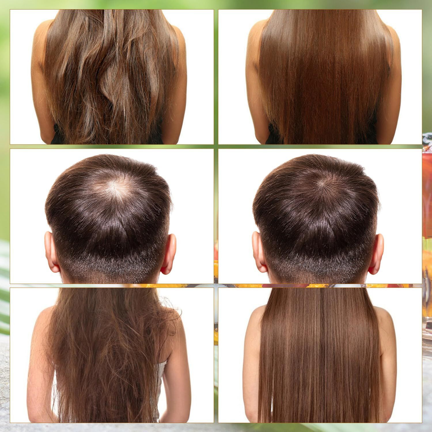 Dssuoa A-Zure Batana Oil For Hair Growth,A-Zure Batana Oil,Batananatural Hair Growthoil,Organic And Natural Ingredients - Promotes Hairgrowth And Thickness For Men & Women