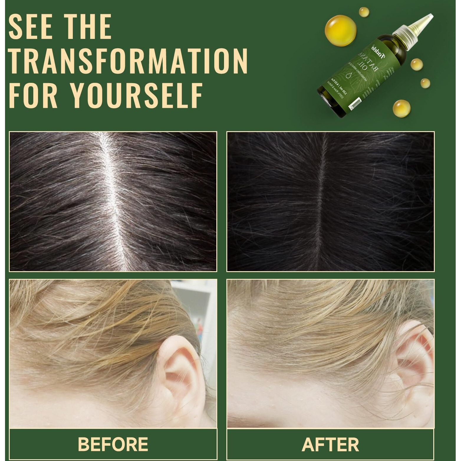 Fadelo Batana Oil - Dr Sebi Organic Oil For Hair Growth, 100% Raw Pure Natural From Honduras, Deeply Nourishing Scalp For Thicker & Stronger Hair, 4.05 Fl Oz