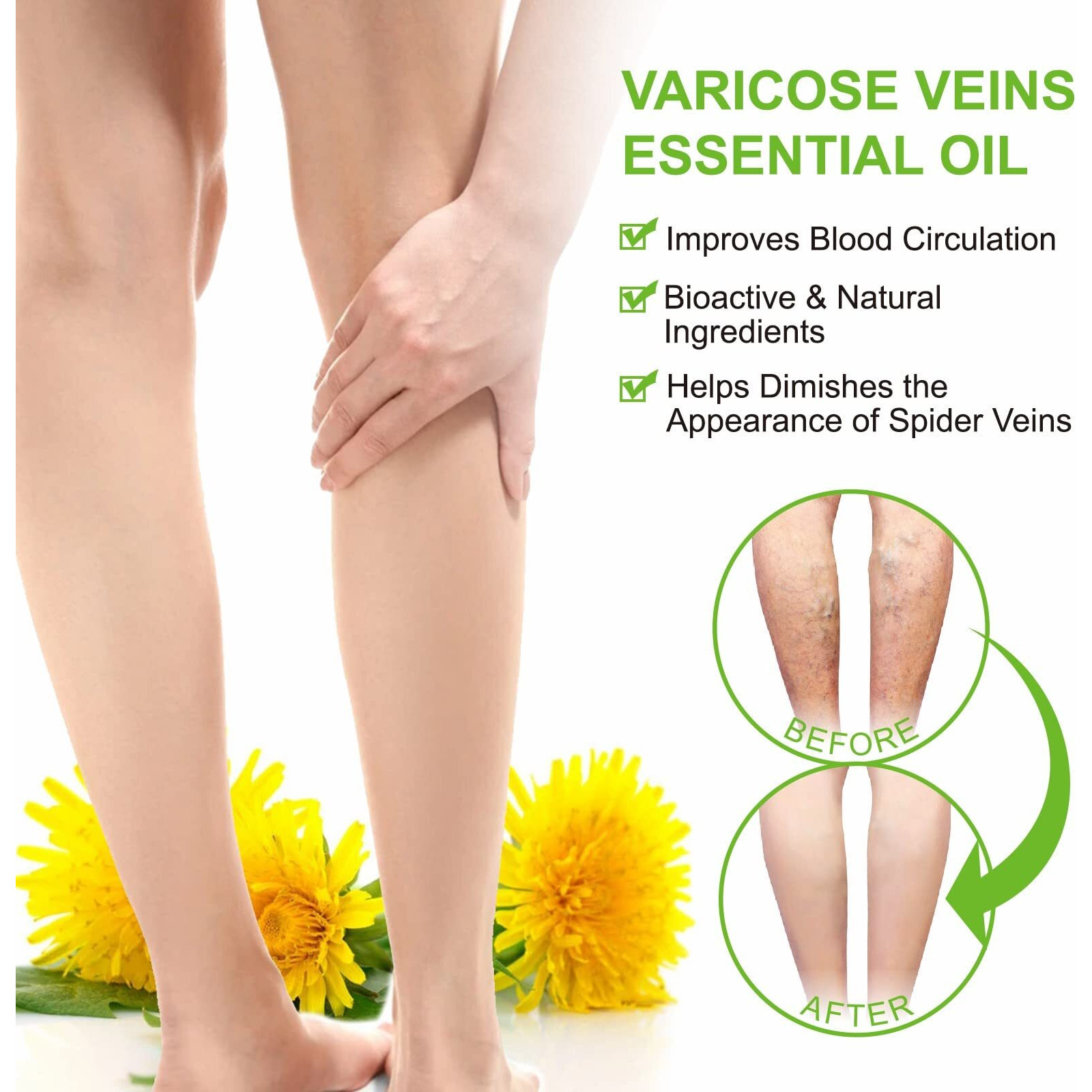 Varicose Veins Essential Oil, Spider Vein Removal Oil For Legs, Natural Varicose Veins Oils 30Ml