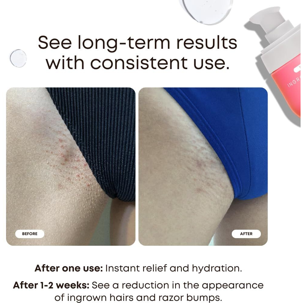 Bushbalm Ingrown Hair And Razor Bumps Routine - Moisturize And Soothe After Shave Skincare For Sensitive Areas - Includes Ingrown Hair Oil (30 Ml) And Exfoliating Scrub (236 Ml) - Watermelon Sugar