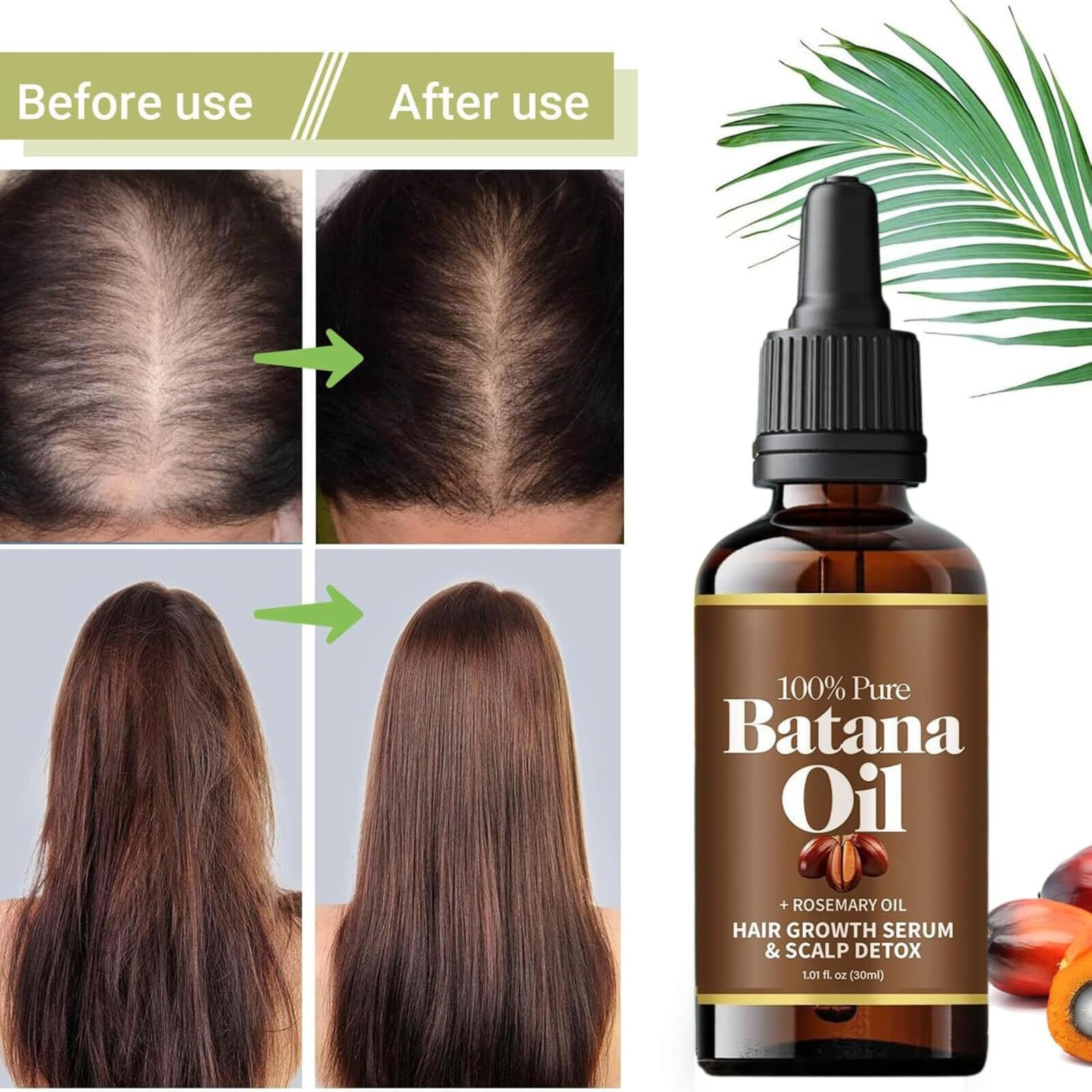 Ttyrbf 2Pcs Batana Oil For Hair,Hair Oil With Rosemary For Hair Growth,For All Hair Types,Batana Hair Oil For Women And Man