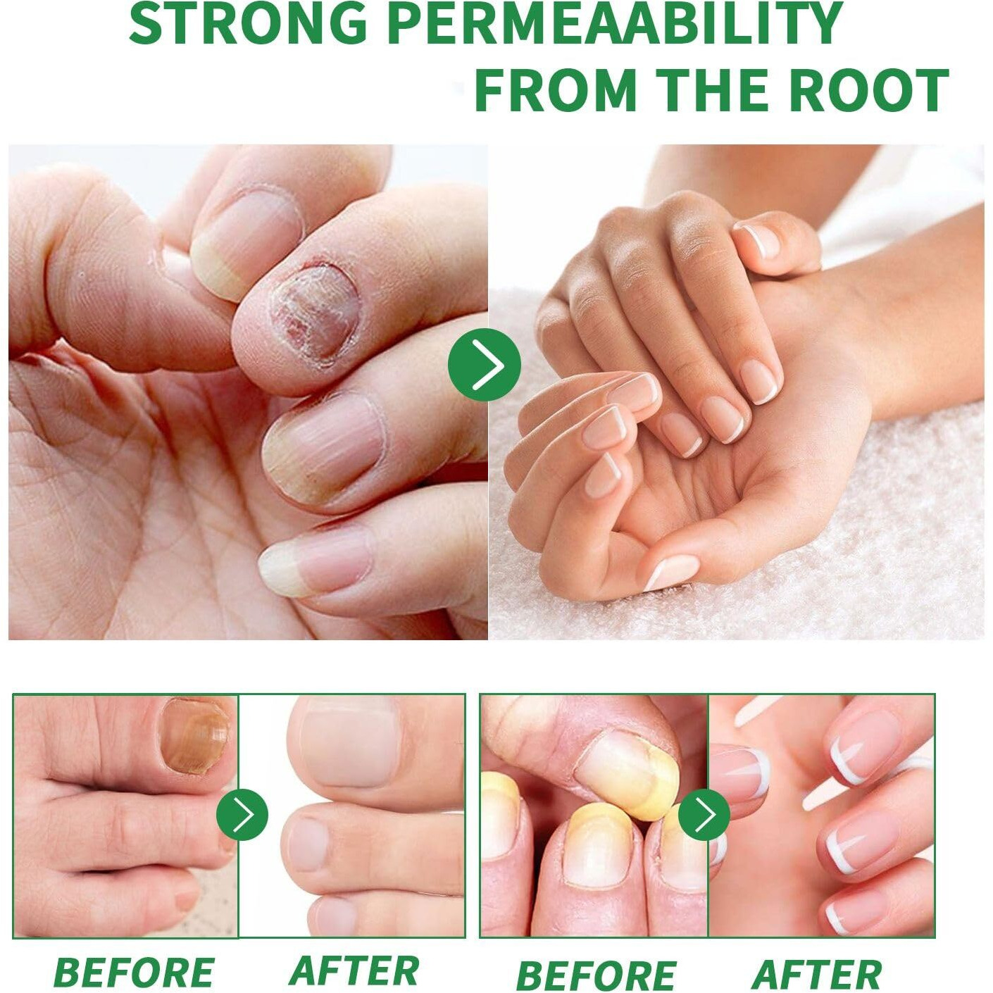 3Pcs Ginger Nail Treatment, Ginger Cuticle Care Oil For Nails, Multi-Purpose Nail Repair Nutrient Oil (02)