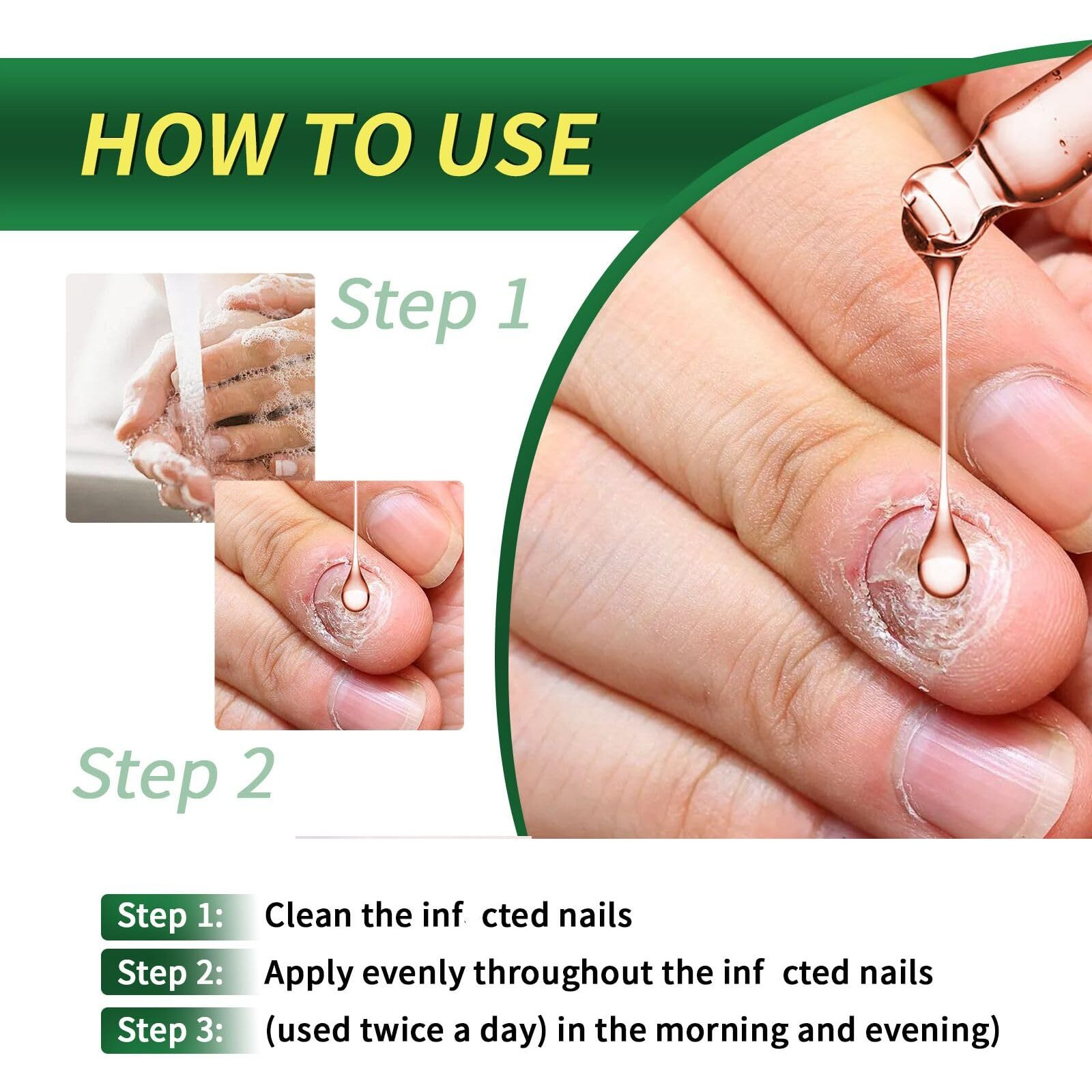 3Pcs Ginger Nail Treatment, Ginger Cuticle Care Oil For Nails, Multi-Purpose Nail Repair Nutrient Oil (02)