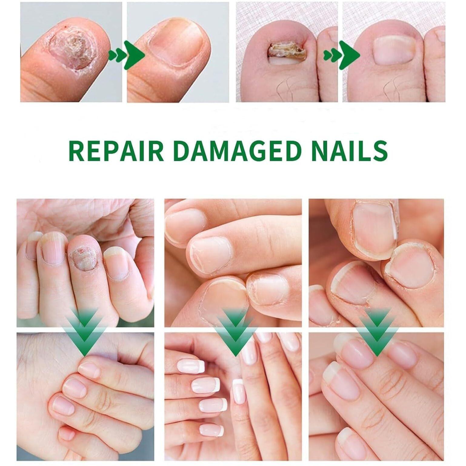 7 Days Nail Growth Serum, 2Pcs 7 Days Ginger Nail Essence, Multi-Purpose Nail Repair, Nail Nutrient Oil Strengthener Oil (2Pcs)