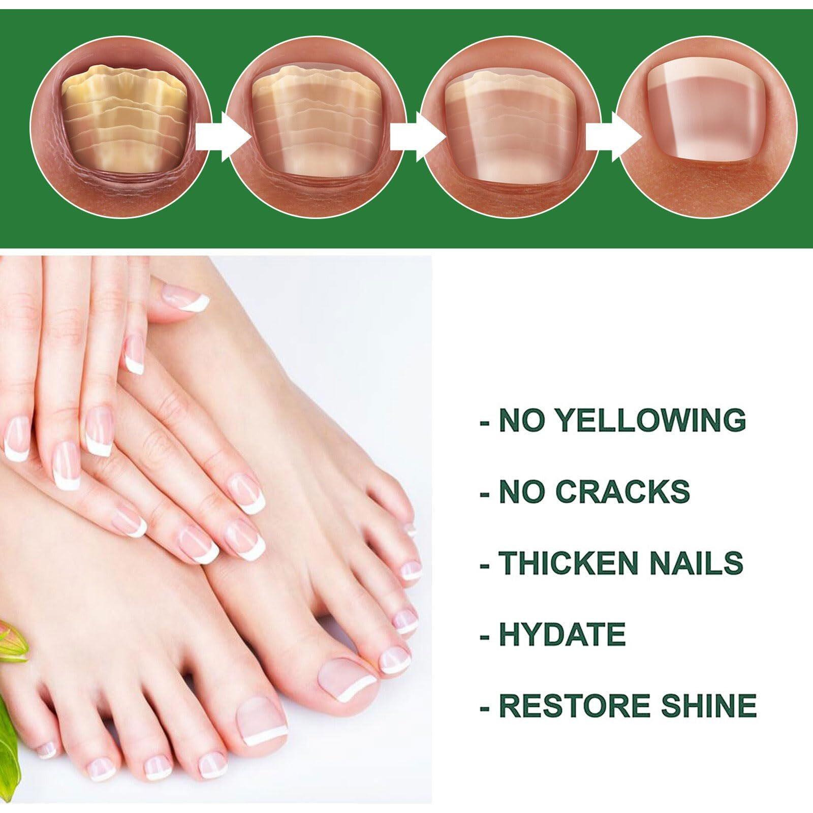 Ginger Nail Treatment Serum Oil, Nail Regrowth Serum, Nutrient Oil For Nail Cuticle Repairing, Promoting Regrowth, Strengthening, Plant-Based Formula