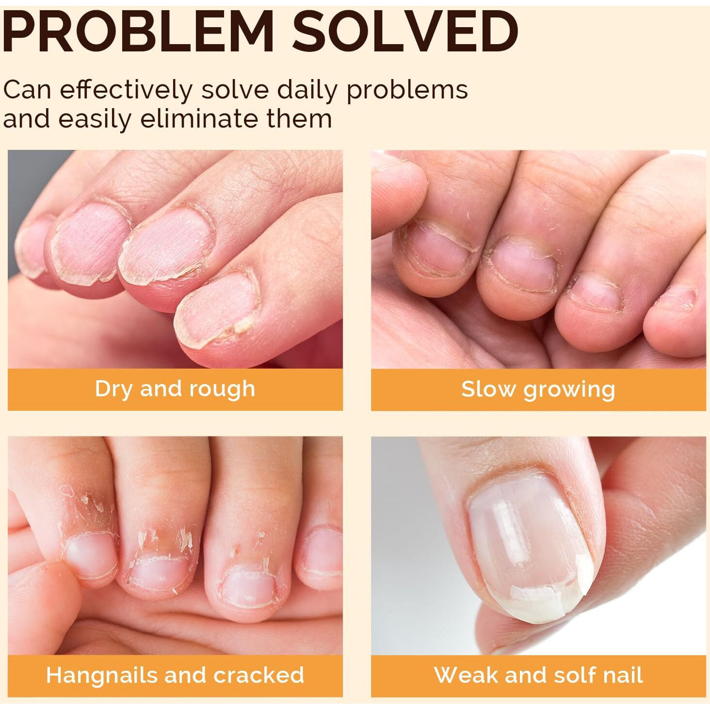 Melodysusie 15Pcs Cuticle Oil Pen Set,Nail Moisturizing Cuticle Oil Enriched With Vitamin E,Softens And Repairs Cuticles,Nail Strengthener,Protects Damaged Skin,Thin Nails