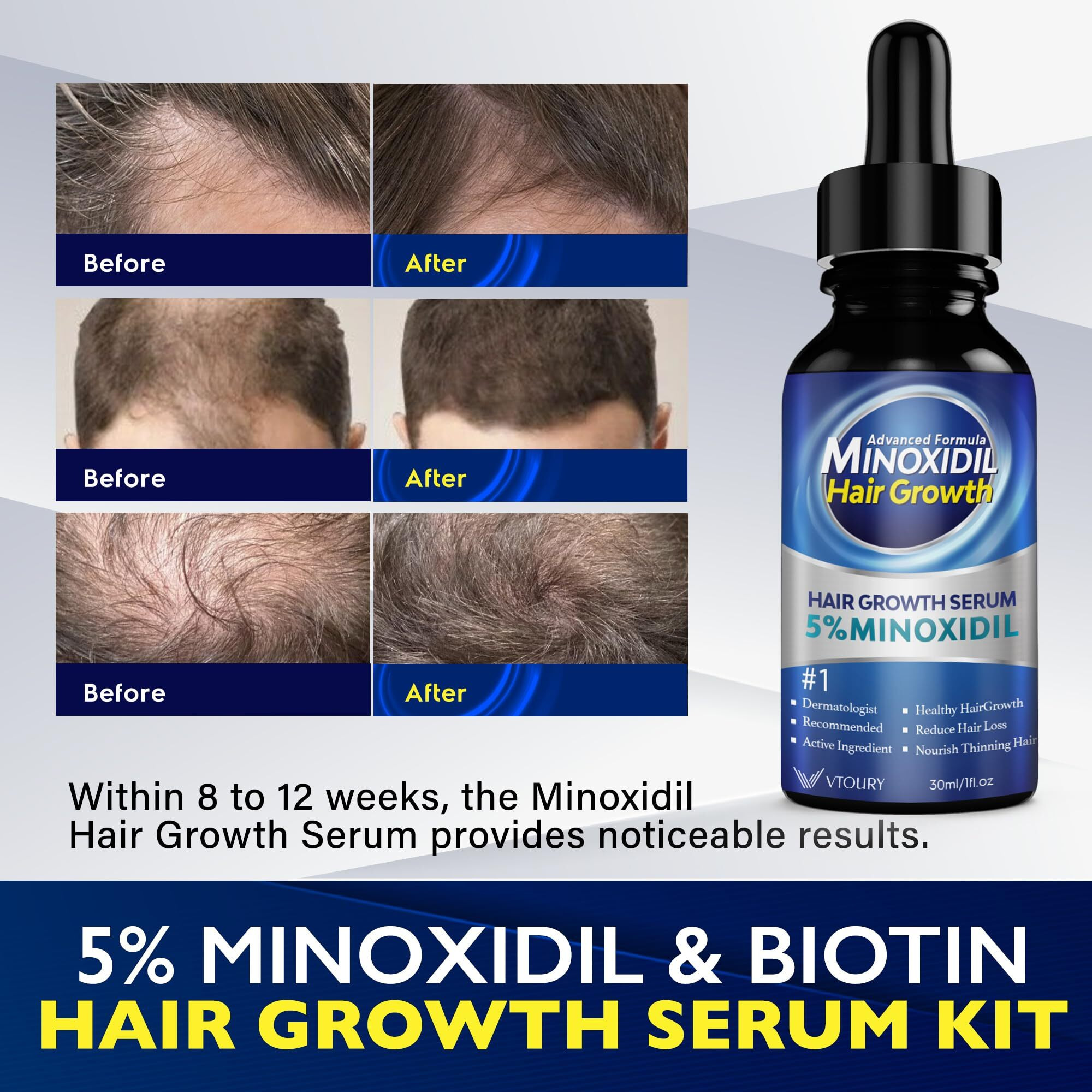 2-Pack Minoxidil For Men And Women Hair Growth- Monoxide For Women Hair Growth, Monoxide For Men Hair, Beard Growth Oil