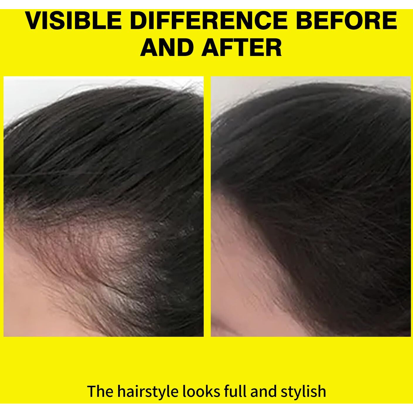 Sevich Vent-Based Hairline & Volume Powder With Botanical Extracts | 2-In-1 Gray Coverage & Oil-Free Fluff | Mirror-Compact For Travel - Dark Grey 6.5G