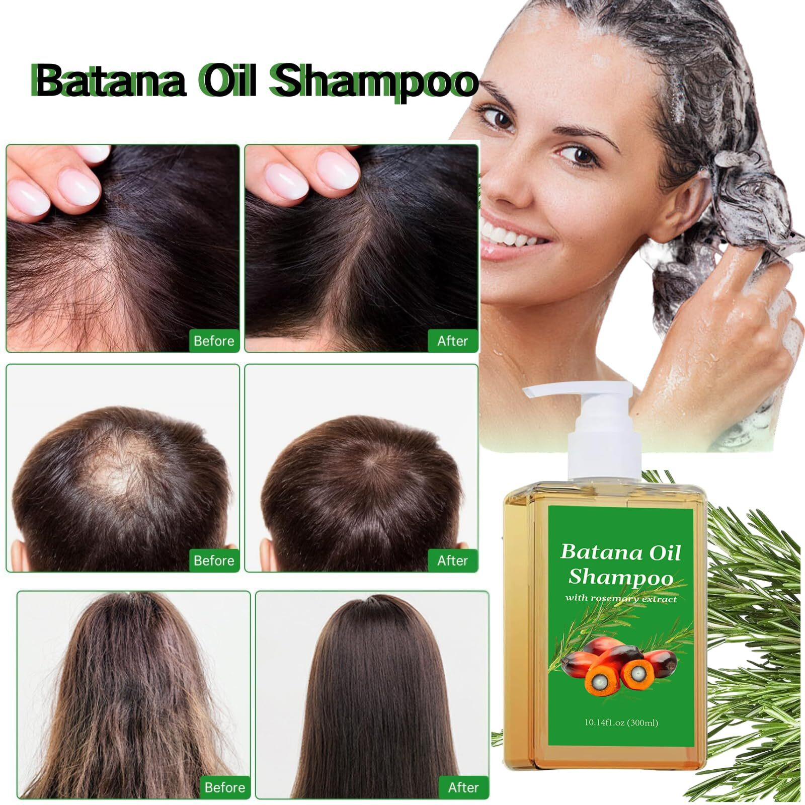 Adutry Batana Oil Shampoo, Batana Shampoo, Rosemary Oil Shampoo, Shampoo De Batana, Batana Shampoo With Rosemary Extract